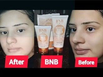 Bnb Whitening Rice Organic Glow Kit | Organic Rice Facial Skin Care Kit, Brightening Face Scrub.